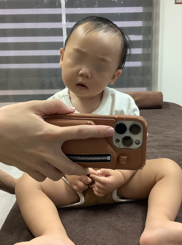 1歳3ヶ月男児の首の傾き(斜頸)の初回確認写真(正面)