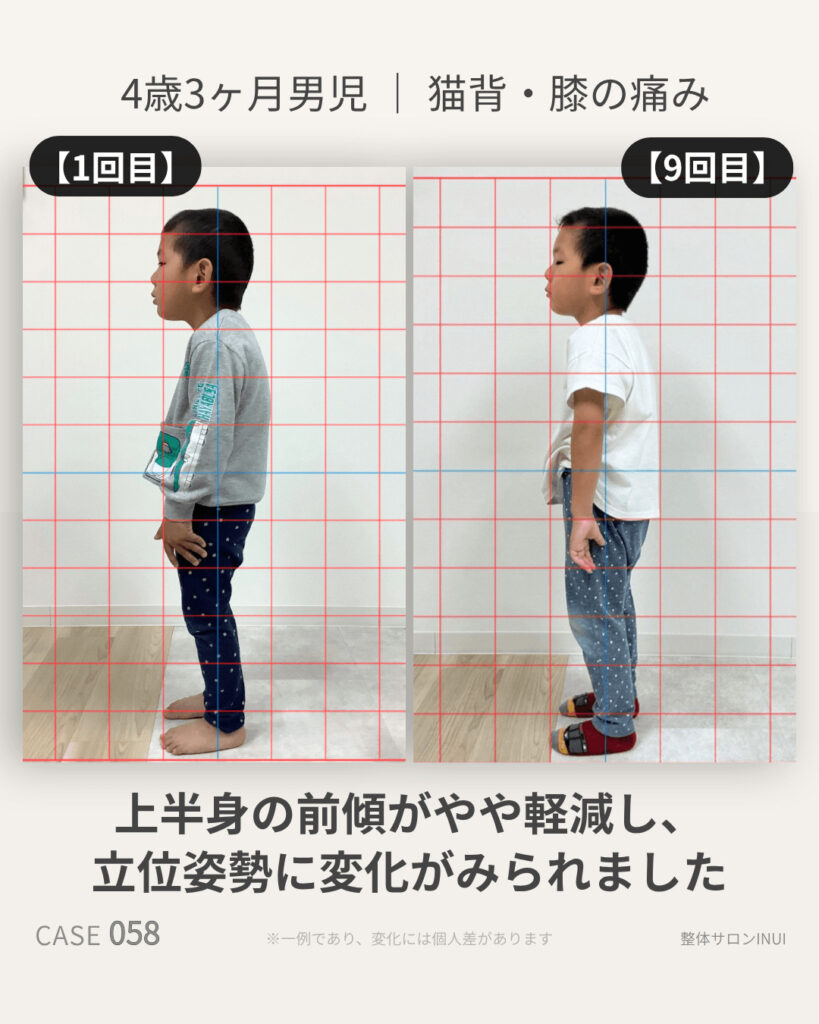 4歳3ヶ月男児の猫背・姿勢不良の9回目来院時