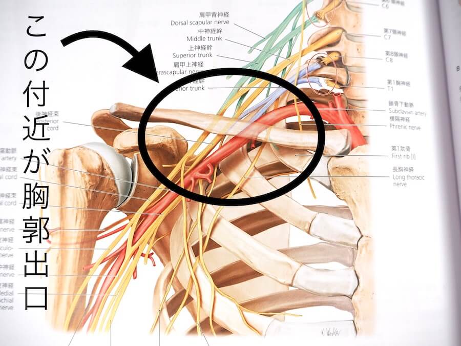 胸郭出口症候群とは何ですか?
