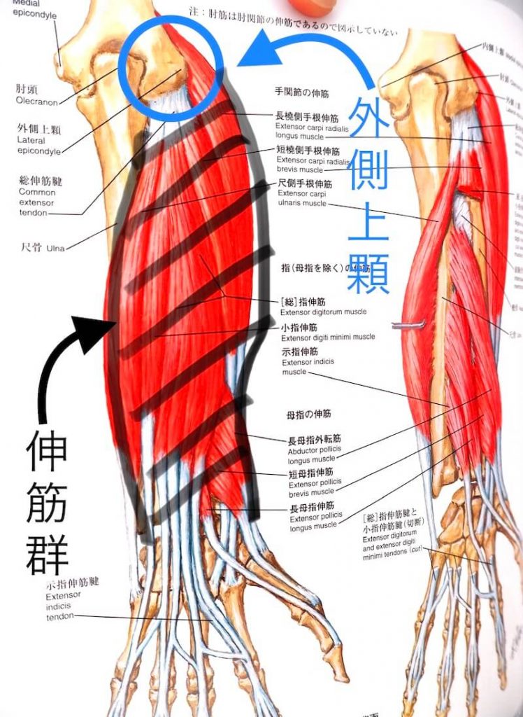 前腕の伸筋群の解剖図イラスト