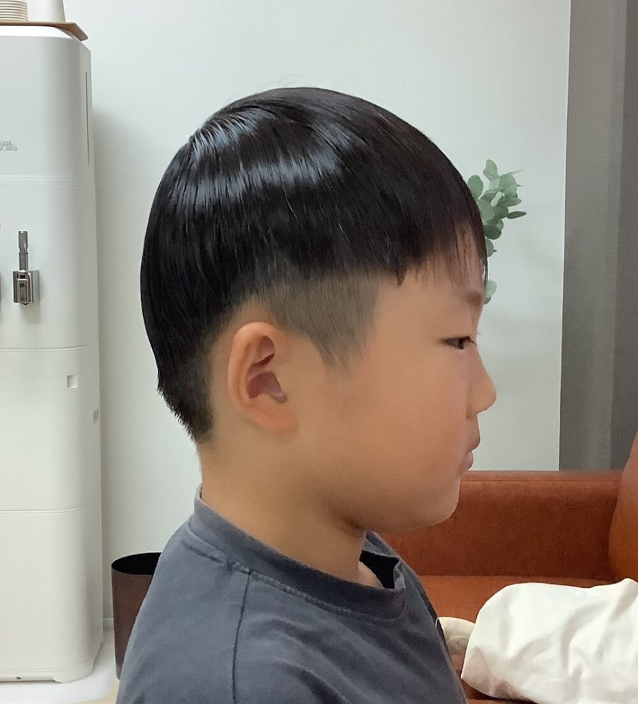 8歳11ヶ月男児の絶壁頭による後頭部の平坦感